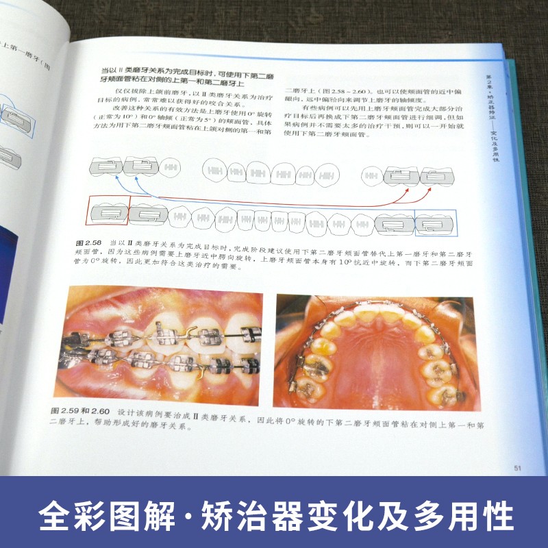 【系統化正畸治療科技】